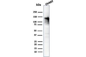 Western Blot Analysis of human Ovary tissue using Caldesmon Mouse Monoclonal Antibody (h-CALD). (Caldesmon anticorps)