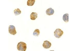 Immunocytochemistry of ATR in K562 cells with this product atR antibody at 2 μg/ml.