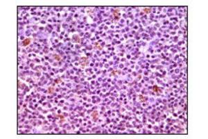 Immunohistochemistry (IHC) image for anti-Induced Myeloid Leukemia Cell Differentiation Protein Mcl-1 (MCL1) antibody (ABIN1844302) (MCL-1 anticorps)