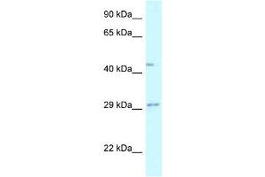 WB Suggested Anti-FUT8 Antibody Titration: 1. (FUT8 anticorps  (N-Term))