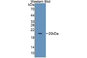 Detection of Recombinant KLRK1, Mouse using Polyclonal Antibody to Killer Cell Lectin Like Receptor Subfamily K, Member 1 (KLRK1) (KLRK1 anticorps  (AA 90-232))
