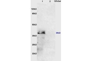 Lane 1: mouse kidney lysates Lane 2: mouse lung lysates probed with Anti AVPR2 Polyclonal Antibody, Unconjugated (ABIN747848) at 1:200 in 4 °C. (IL10RB anticorps  (AA 21-120))