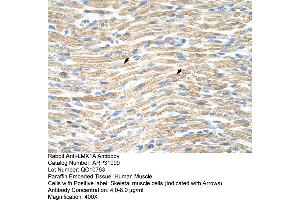 Rabbit Anti-LMX1A Antibody  Paraffin Embedded Tissue: Human Muscle Cellular Data: Skeletal muscle cells Antibody Concentration: 4. (LMX1A anticorps  (Middle Region))