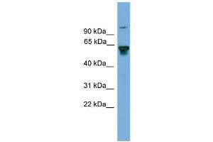 WB Suggested Anti-BIN2 Antibody Titration: 0.