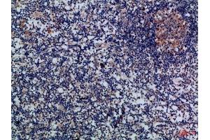 Immunohistochemical analysis of paraffin-embedded Human-lymph, antibody was diluted at 1:100