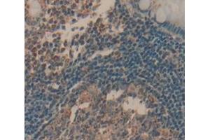 IHC-P analysis of Human Tissue, with DAB staining. (LAT anticorps  (AA 25-221))