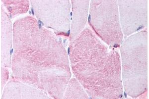 Human Skeletal Muscle (formalin-fixed, paraffin-embedded) stained with CACNG1 antibody ABIN214733 at 10 ug/ml followed by biotinylated goat anti-rabbit IgG secondary antibody ABIN481713, alkaline phosphatase-streptavidin and chromogen.