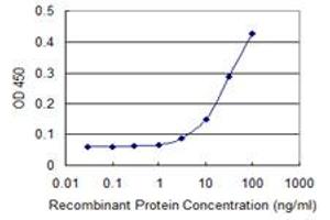 Detection limit for recombinant GST tagged TUBB is 1 ng/ml as a capture antibody. (TUBB anticorps  (AA 1-444))