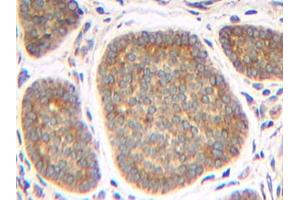 Image no. 1 for anti-Tumor Necrosis Factor (Ligand) Superfamily, Member 13 (TNFSF13) antibody (ABIN465418) (TNFSF13 anticorps)