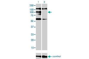 Western blot analysis of NBR1 over-expressed 293 cell line, cotransfected with NBR1 Validated Chimera RNAi (Lane 2) or non-transfected control (Lane 1). (NBR1 anticorps  (AA 2-96))