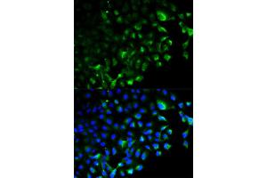 Immunofluorescence analysis of HeLa cell using TRAF2 antibody. (TRAF2 anticorps)