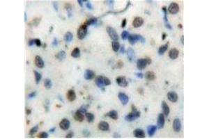Used in DAB staining on fromalin fixed paraffin-embedded Stomach tissue (Nuclear Factor kappa B2 (AA 38-343) anticorps)