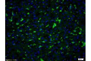 Formalin-fixed and paraffin embedded rat liver labeled with Anti- PGT Polyclonal Antibody, Unconjugated (ABIN1386754) at 1:200 followed by conjugation to the secondary antibody Goat Anti-Rabbit IgG, FITC conjugated used at 1:200 dilution for 40 minutes at 37°C and DAPI staining (SLCO2A1 anticorps  (AA 611-643))