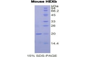 SDS-PAGE analysis of Mouse Hexosaminidase B beta Protein. (HEXB Protéine)
