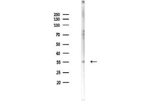 Western blot analysis of lysates from F10-LUC cells(starvation 24h treatment), using AIM2 Antibody at 1/1000 dilution.