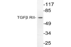 Image no. 1 for anti-Transforming Growth Factor, beta Receptor II (70/80kDa) (TGFBR2) antibody (ABIN271848) (TGFBR2 anticorps)