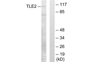 Western blot analysis of extracts from LOVO cells, using TLE2 antibody. (TLE2 anticorps  (Internal Region))