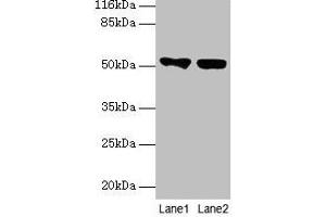 Western blot All lanes: KRT8 antibody at 2 μg/mL Lane 1: A549 whole cell lysate Lane 2: MCF-7 whole cell lysate Secondary Goat polyclonal to rabbit IgG at 1/10000 dilution Predicted band size: 54, 57 kDa Observed band size: 54 kDa