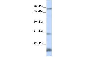 SMYD4 antibody used at 0. (SMYD4 anticorps  (N-Term))