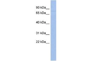 WB Suggested Anti-ZNF233 Antibody Titration:  0. (ZNF233 anticorps  (Middle Region))