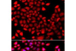 Immunofluorescence analysis of A549 cells using RARG Polyclonal Antibody (Retinoic Acid Receptor gamma anticorps)