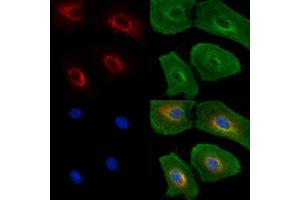 ABIN6262924 and ABIN6277599 staining  cells(UV treatment) by IF/ICC. (Lamin B Receptor anticorps  (Internal Region))