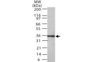 Western blot analysis of MKI67IP in 30 ugs of Ramos cell lysate. (NIFK anticorps  (AA 100-200))