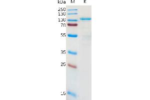 Human L Protein, hFc Tag on SDS-PAGE under reducing condition.