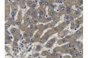 Detection of APOL2 in Human Liver Tissue using Polyclonal Antibody to Apolipoprotein L2 (APOL2)