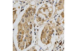 Immunohistochemistry of paraffin-embedded human stomach using MAPK10 antibody at dilution of 1:200 (x400 lens) (MAPK10 anticorps)