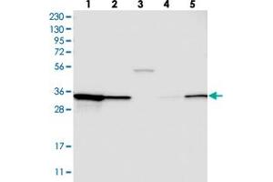 Western blot analysis of Lane 1: RT-4, Lane 2: U-251 MG, Lane 3: Human Plasma, Lane 4: Liver, Lane 5: Tonsil with STARD10 polyclonal antibody . (STARD10 anticorps)