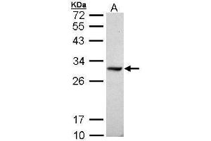 WB Image Sample (30 ug of whole cell lysate) A: Raji 12% SDS PAGE antibody diluted at 1:1000 (DDAH1 anticorps  (C-Term))