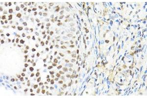 Immunohistochemistry of paraffin-embedded Rat ovary using BACH1 Polyclonal Antibody at dilution of 1:100 (40x lens).