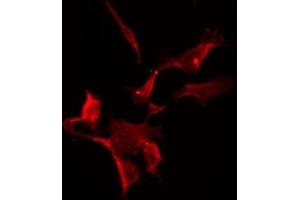 ABIN6275573 staining HuvEc by IF/ICC.