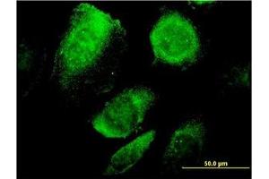 Image no. 1 for anti-B-Cell Receptor-Associated Protein 29 (BCAP29) (AA 125-241) antibody (ABIN599278) (BCAP29 anticorps  (AA 125-241))