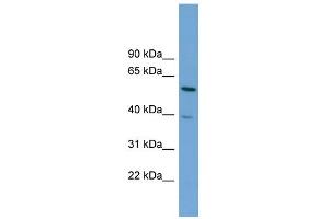 WB Suggested Anti-TOM1 Antibody Titration: 0. (TOM1 anticorps  (Middle Region))
