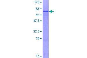 Image no. 1 for Zinc Finger Protein 566 (ZNF566) (AA 1-418) protein (GST tag) (ABIN1326292)