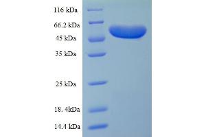 SDS-PAGE (SDS) image for Major Outer Membrane Protein (MOMP) (AA 24-389) protein (His-SUMO Tag) (ABIN5710880)