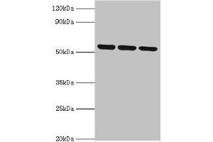 Western blot All lanes: MYOT antibody at 2 μg/mL Lane 1: 293T whole cell lysate Lane 2: HepG2 whole cell lysate Lane 3: Mouse skeletal muscle tissue Secondary Goat polyclonal to rabbit IgG at 1/10000 dilution Predicted band size: 56, 36 kDa Observed band size: 56 kDa (Myotilin anticorps  (AA 443-498))