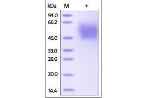 Human MICA, His Tag on SDS-PAGE under reducing (R) condition. (MICA Protein (AA 24-308) (His tag))