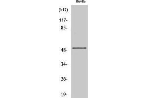 Western Blotting (WB) image for anti-Inositol-Trisphosphate 3-Kinase A (ITPKA) (C-Term) antibody (ABIN3185213)