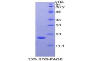 SDS-PAGE analysis of Mouse LYAR Protein. (LYAR Protéine)