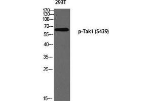 Western Blot (WB) analysis of 293T using p-Tak1 (S439) antibody.