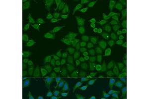 Immunofluorescence analysis of U2OS cells using PLA2G4C Polyclonal Antibody at dilution of 1:100. (PLA2G4C anticorps)