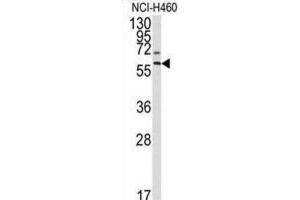 Western Blotting (WB) image for anti-Matrix Metallopeptidase 17 (Membrane-inserted) (MMP17) antibody (ABIN3002547) (MMP17 anticorps)