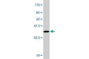 Western Blot detection against Immunogen (34. (IL23R anticorps  (AA 553-628))