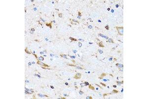 Immunohistochemistry of paraffin-embedded mouse spinal cord using PTRH2 antibody. (PTRH2 anticorps  (AA 40-179))