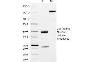SDS-PAGE Analysis Purified IgM Mouse Monoclonal Antibody (IM373). (IGHM anticorps)