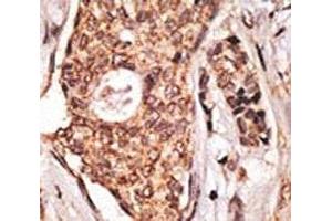 IHC analysis of FFPE human lymph node with ICOS antibody