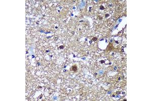 Immunohistochemistry of paraffin-embedded Mouse spinal cord using TSN Rabbit pAb  at dilution of 1:100 (40x lens).